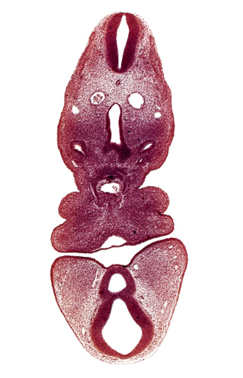 anterior dural venous plexus, dermatomyotome 5 (C-1), dorsal aorta, internal carotid artery, mamillary recess, mandibular prominence of pharyngeal arch 1, maxillary prominence of pharyngeal arch 1, oral fissure, pharyngeal arch 2, pharyngeal groove 1, precardinal vein, prosencoel (third ventricle), truncus arteriosus, ultimopharyngeal pouch