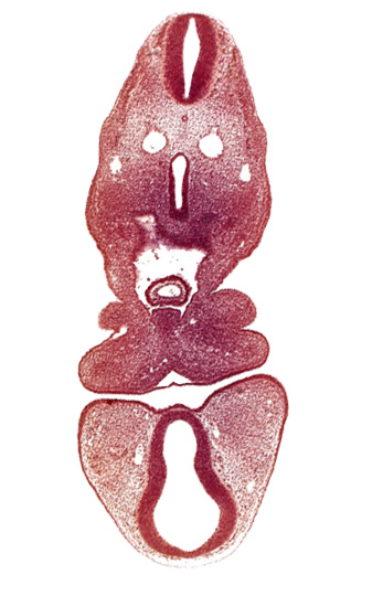 anterior dural vein, caudal edge of ultimopharyngeal pouch, dermatomyotome 5 (C-1), dorsal thalamus (diencephalon), internal carotid artery, mandibular prominence of pharyngeal arch 1, maxillary prominence of pharyngeal arch 1, oral fissure, origin of intersegmental artery from dorsal aorta, pericardial cavity, precardinal vein, prosencoel (third ventricle), tracheo-esophageal tube, truncus arteriosus, ventral thalamus (diencephalon)