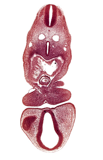 C-1 spinal ganglion primordium, caudal edge of optic vesicle, dermatomyotome 5 (C-1), dorsal aorta, dorsal thalamus (diencephalon), left atrium, mandibular prominence of pharyngeal arch 1, pericardial cavity, primordial maxillary vein, prosencoel (third ventricle), right atrium, tracheo-esophageal tube, truncus arteriosus