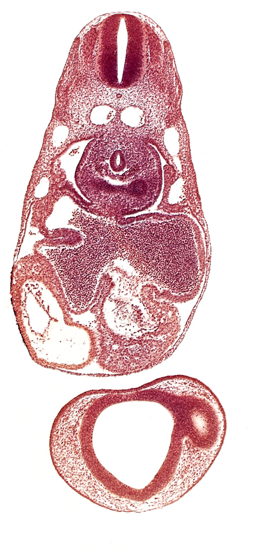 common atrioventricular canal, common cardinal vein, dermatomyotome 7 (C-3), endocardium, epimyocardium, esophagus primordium, intraretinal space (optic vesicle cavity), left atrium, left lung bud, notochord, postcardinal vein, prosencoel (third ventricle), right atrium, sinu-atrial foramen, sinus venosus