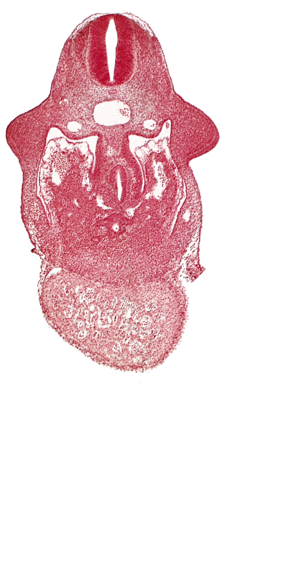alar plate(s), basal plate, coelomic cavity, common aorta, common ventricle, dermatomyotome 9 (C-5), dorsal pancreatic bud, duodenum primordium, hepatic lamina(e), hepatic sinusoid, hepatocardiac vein, postcardinal vein, septum transversum, specialized coelomic wall, upper limb bud