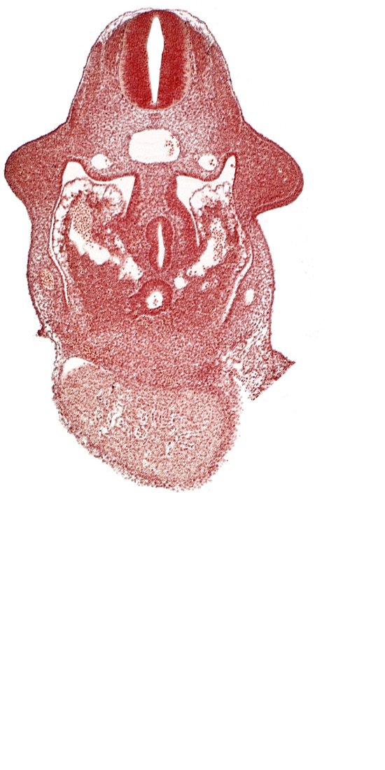 alar plate(s), amnion attachment, basal plate, coelomic cavity, common aorta, common ventricle, dorsal pancreatic bud, duodenum primordium, hepatic antrum, hepatocardiac vein, left umbilical vein, postcardinal vein, septum transversum, upper limb bud