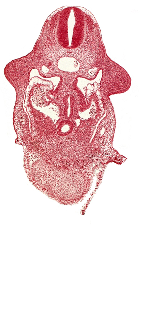 C-5 spinal ganglion primordium, amnion attachment, aorta, caudal edge of common ventricle, dermatomyotome 9 (C-5), dorsal pancreatic bud, hepatic antrum, left hepatocardiac vein, notochord, postcardinal vein, right hepatocardiac vein, septum transversum, specialized coelomic wall, upper limb bud