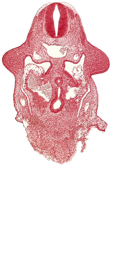 amnion attachment, aorta, caudal edge of common ventricle, dermatomyotome 9 (C-5), dorsal intersegmental artery, dorsal pancreatic bud, hepatic antrum, left hepatocardiac vein, notochord, postcardinal vein, right hepatocardiac vein, specialized coelomic wall, upper limb bud