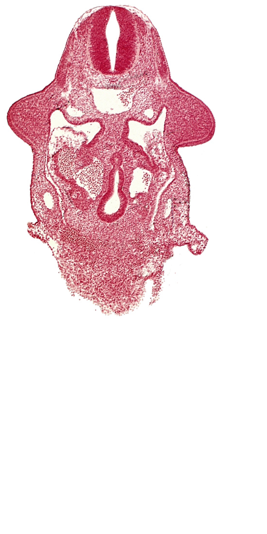amnion attachment, aorta, caudal edge of common ventricle, dermatomyotome 9 (C-5), dorsal pancreatic bud, hepatic antrum, left hepatocardiac vein, notochord, postcardinal vein, right hepatocardiac vein, specialized coelomic wall, upper limb bud