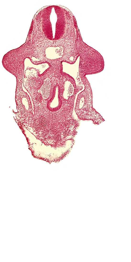 amnion attachment, aorta, apical ectodermal ridge, dermatomyotome 9 (C-5), duodenum primordium, hepatic antrum, marginal layer, notochord, postcardinal vein, sulcus limitans, upper limb bud