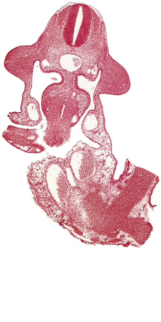 C-6 spinal ganglion primordium, allantois, aorta, apical ectodermal ridge, coelomic cavity, common umbilical vein, communication between coelomic cavity and extra-embryonic coelom, dermatomyotome 10 (C-6), dorsal mesentery, left umbilical artery, left vitelline (omphalomesenteric) vein, midgut, neural canal, postcardinal vein, right umbilical artery, umbilical vesicle stalk, upper limb bud