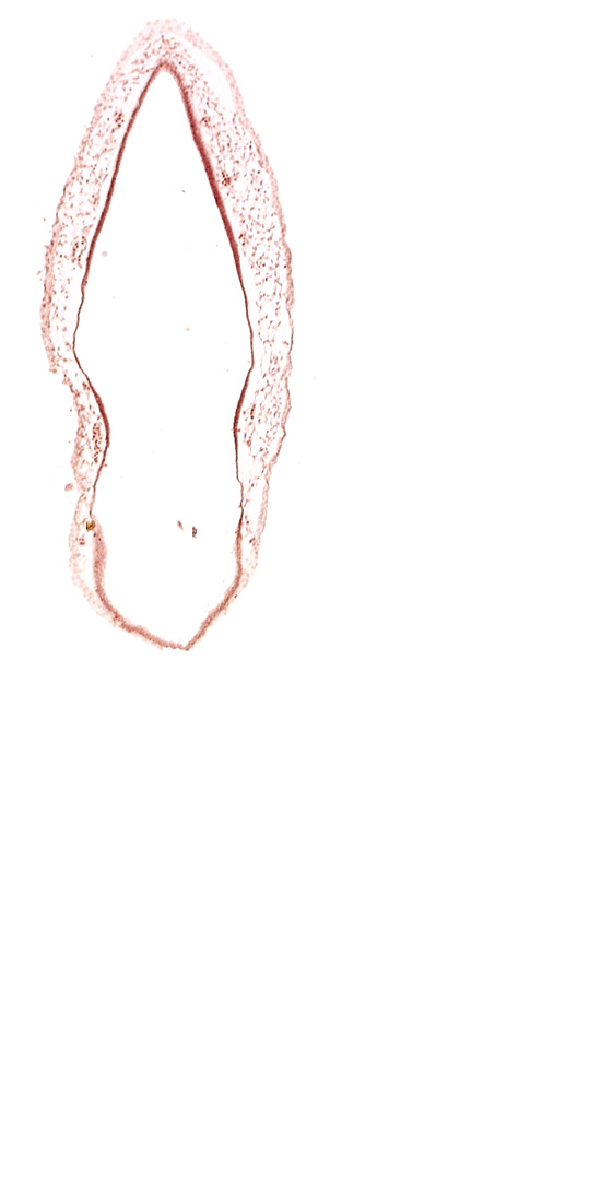 alar plate(s), head mesenchyme, rhombencoel (fourth ventricle), roof plate of rhombencephalon, surface ectoderm, venous plexus(es)
