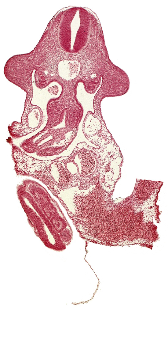 alar plate(s), aorta, basal plate, left umbilical artery, left umbilical vein, marginal layer, mesentery proper, mesonephric duct, midgut, neural canal, neural tube, omphaloenteric duct, paraxial mesoderm, right umbilical artery, right vitelline (omphalomesenteric) vein, somite 30 (S-1), somite 31 (S-2), somite 32 (S-3), upper limb bud