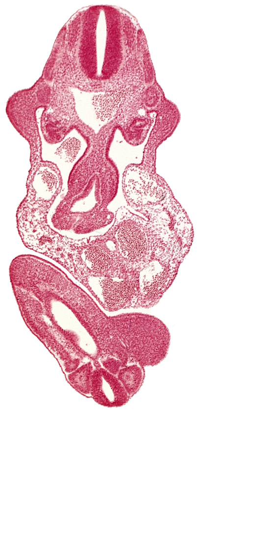 abdominal wall, allantois, aorta, caudal eminence, cloaca, dermatomyotome 11 (C-7), intersegmental artery, left umbilical artery, lower limb bud, mesonephric duct, origin of primary intestinal plexus artery, somite 29 (L-5), somite 30 (S-1), somite 31 (S-2), upper limb bud