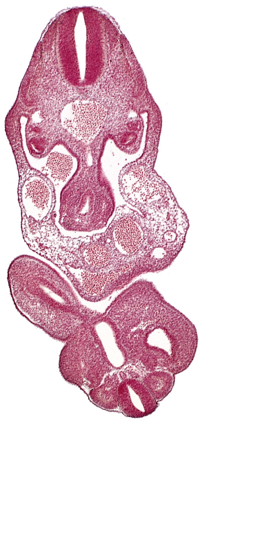C-8 spinal ganglion primordium, caudal edge of upper limb bud, caudal eminence, cloaca, cloacal membrane, coelom, dermatomyotome 12 (C-8), left umbilical artery, left umbilical vein, lower limb bud, mesonephric duct, mesonephric vesicle(s), notochord, origin of primary intestinal plexus artery, right umbilical vein, somite 28 (L-4), tail gut