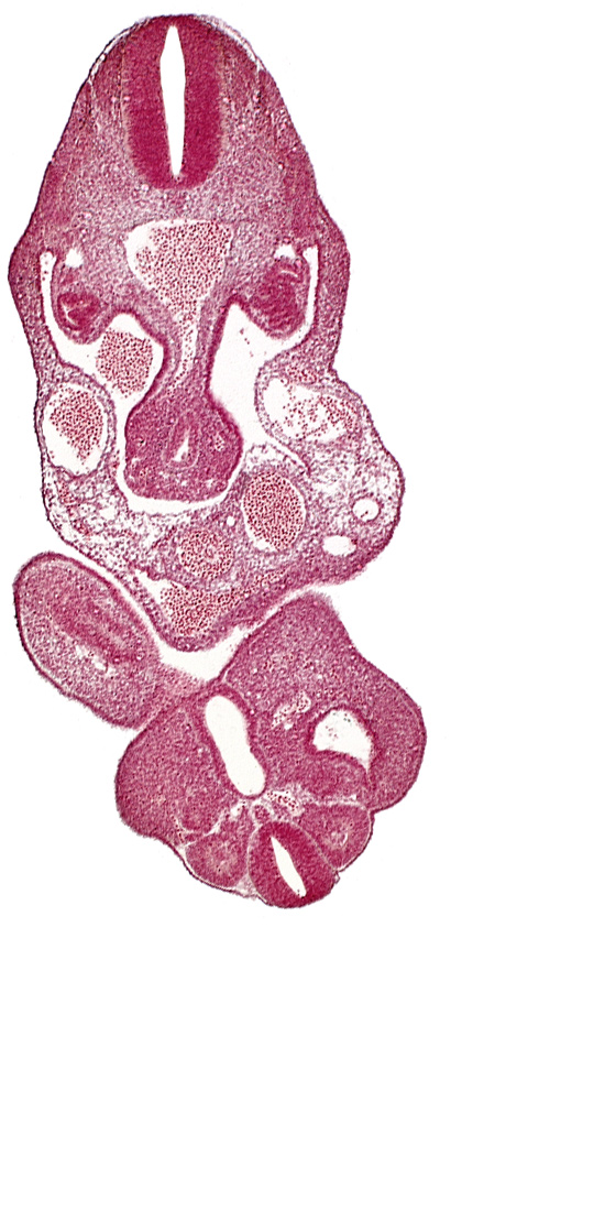 caudal eminence, cloaca, cloacal membrane, coelom, dermatomyotome 12 (C-8), left umbilical artery, left umbilical vein, lower limb bud, notochord, primary intestinal plexus artery, right umbilical vein, somite 28 (L-4)