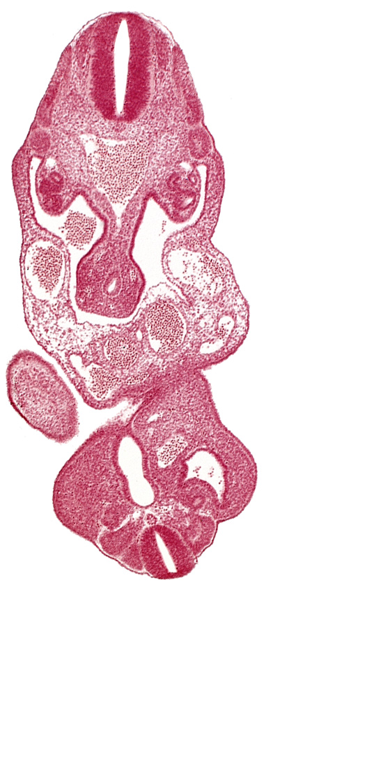 aorta, caudal eminence, cloaca, coelom, dermatomyotome 13 (T-1), left umbilical artery, left umbilical vein, lower limb bud, mesonephric duct, notochord, primary intestinal plexus artery, right umbilical vein, somite 28 (L-4)