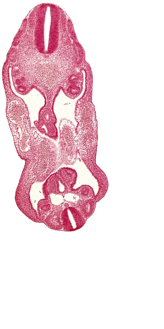 aorta, coelom, dermatomyotome 14 (T-2), dermatomyotome 26 (L-2), left common iliac artery, left umbilical artery, mesonephric duct, neural canal, right common iliac artery, right umbilical artery, right umbilical vein