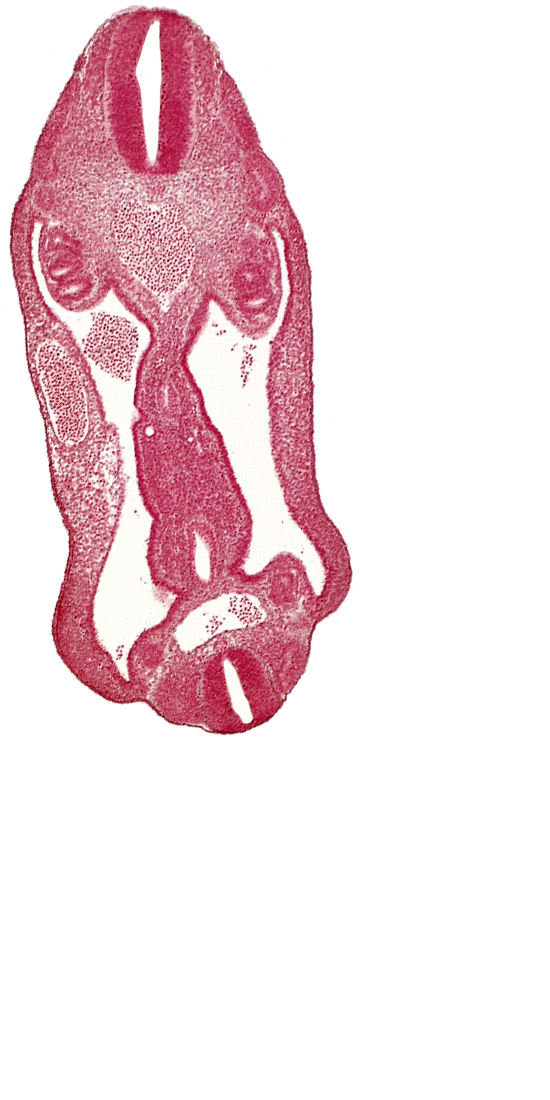 aorta, aortic bifurcation, coelom, dermatomyotome 15 (T-3), dermatomyotome 26 (L-2), hindgut, mesentery, neural tube, notochord