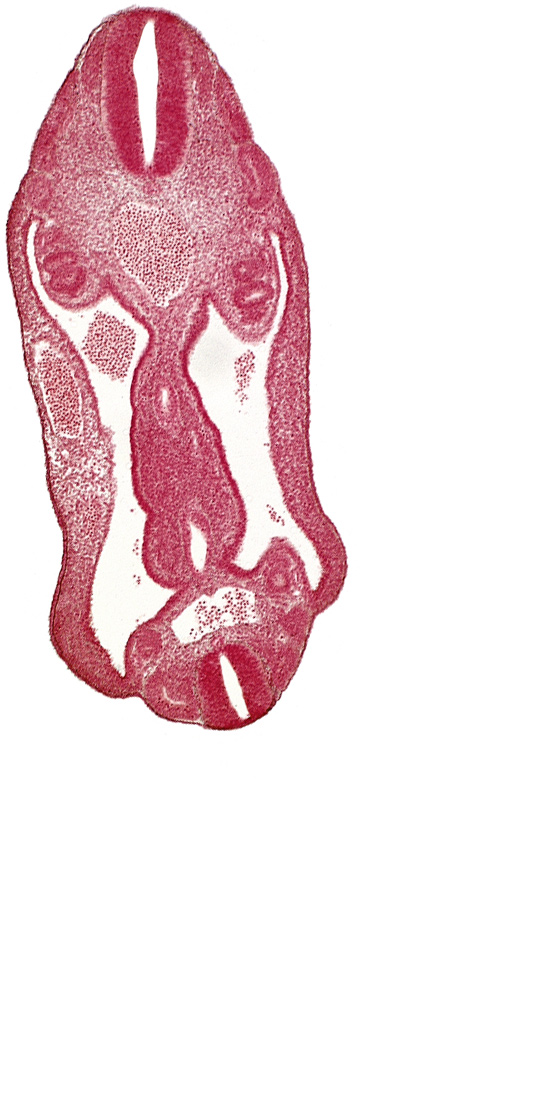 aorta, aortic bifurcation, coelom, dermatomyotome 15 (T-3), dermatomyotome 16 (T-4), dermatomyotome 26 (L-2), hindgut, mesentery, neural tube, notochord