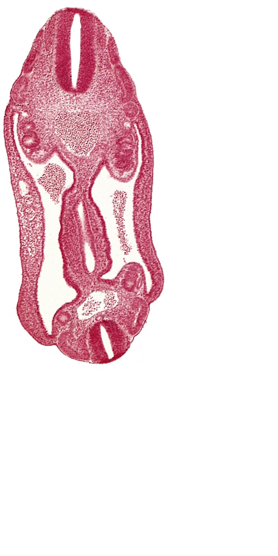 T-3 spinal ganglion primordium, aorta, continuity of hindgut, dermatomyotome 15 (T-3), dermatomyotome 16 (T-4), dermatomyotome 25 (L-1), hindgut, mesentery, neural tube, notochord