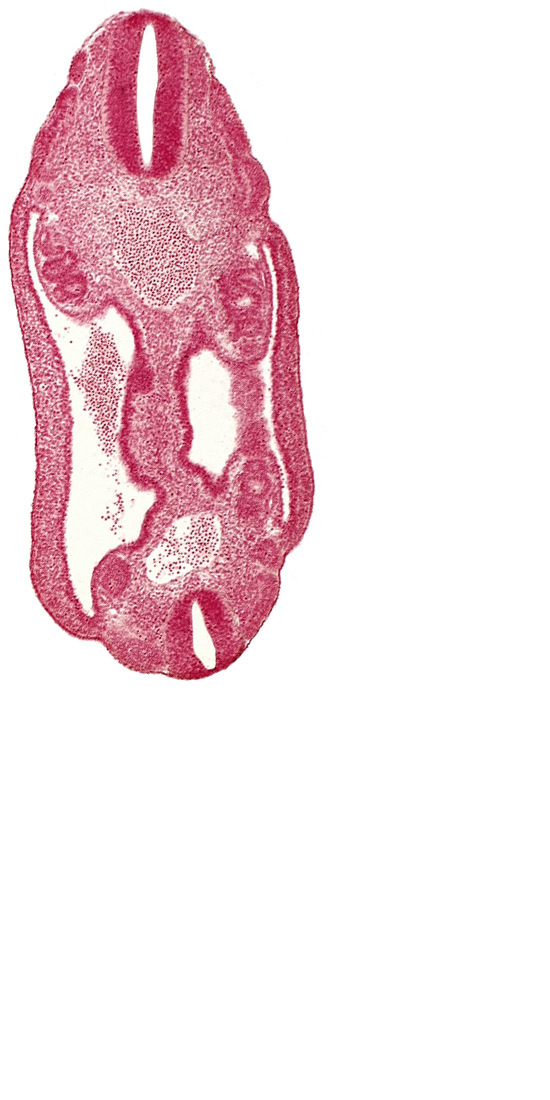 aorta, coelom, dermatomyotome 16 (T-4), dermatomyotome 17 (T-5), dermatomyotome 25 (L-1), mesonephric duct, mesonephric vesicle(s), mesothelium, neural tube, notochord, sclerotome, somatic mesoderm, splanchnic mesoderm