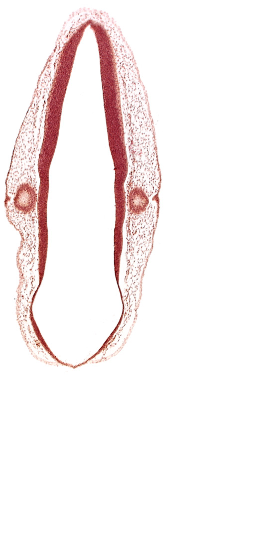 alar plate of rhombencephalon, ectodermal tag of otic vesicle, otic vesicle, rhombencoel (fourth ventricle), roof plate of rhombencephalon