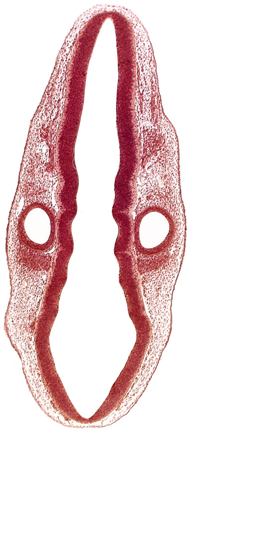 dermatomyotome 1 (O-1), otic vesicle, primordium of facial and vestibulocochlear nerves (CN VII and CN VIII), primordium of hypoglossal nerve (CN XII), primordium of vagus and accessory nerves (CN X and CN XI), rhombencoel (fourth ventricle), rhombomere 5, rhombomere 6, rhombomere 7