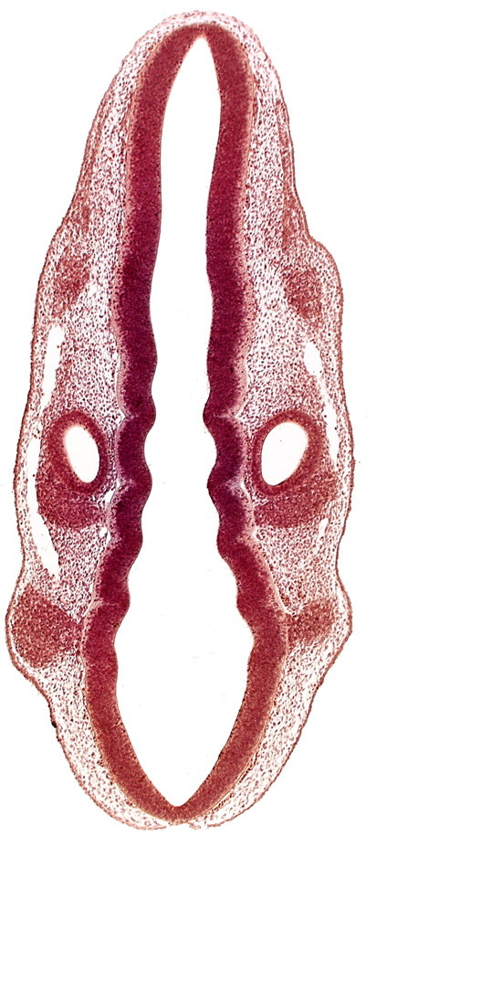 dermatomyotome 1 (O-1), dermatomyotome 2 (O-2) , marginal layer, otic vesicle, primary head vein, primordium of facial and vestibulocochlear nerves (CN VII and CN VIII), primordium of trigeminal nerve (CN V), primordium of vagus nerve (CN X), rhombencoel (fourth ventricle), rhombomere 2, rhombomere 4, rhombomere 5, rhombomere 6