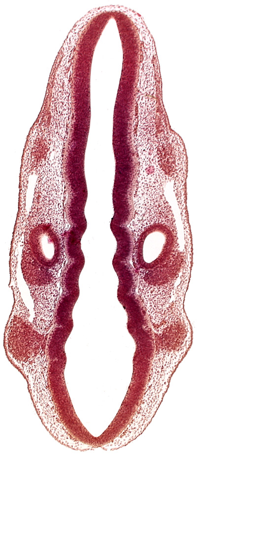 dermatomyotome 1 (O-1), dermatomyotome 2 (O-2) , marginal layer, otic vesicle, primary head vein, primordium of facial and vestibulocochlear nerves (CN VII and CN VIII), primordium of glossopharyngeal nerve (CN IX), rhombencoel (fourth ventricle), rhombomere 2, rhombomere 4, rhombomere 5, rhombomere 6, rhombomere 7, root of trigeminal nerve (CN V)