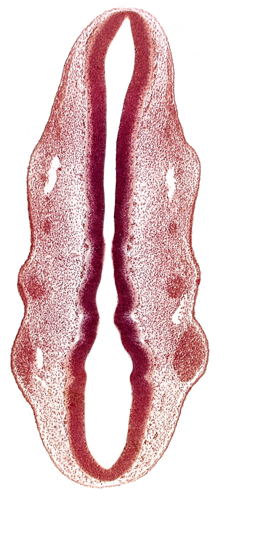 dermatomyotome 2 (O-2) , primary head vein, primordium of facial nerve (CN VII), primordium of glossopharyngeal nerve (CN IX), primordium of trigeminal nerve (CN V), rhombomere 2, rhombomere 3, rhombomere 4, rhombomere 5, rhombomere 6