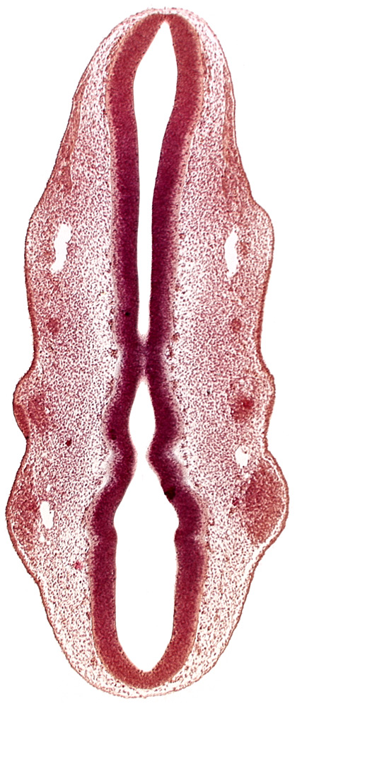 dermatomyotome 2 (O-2) , primary head vein, primordium of facial nerve (CN VII), primordium of glossopharyngeal nerve (CN IX), primordium of trigeminal nerve (CN V), rhombomere 2, rhombomere 4
