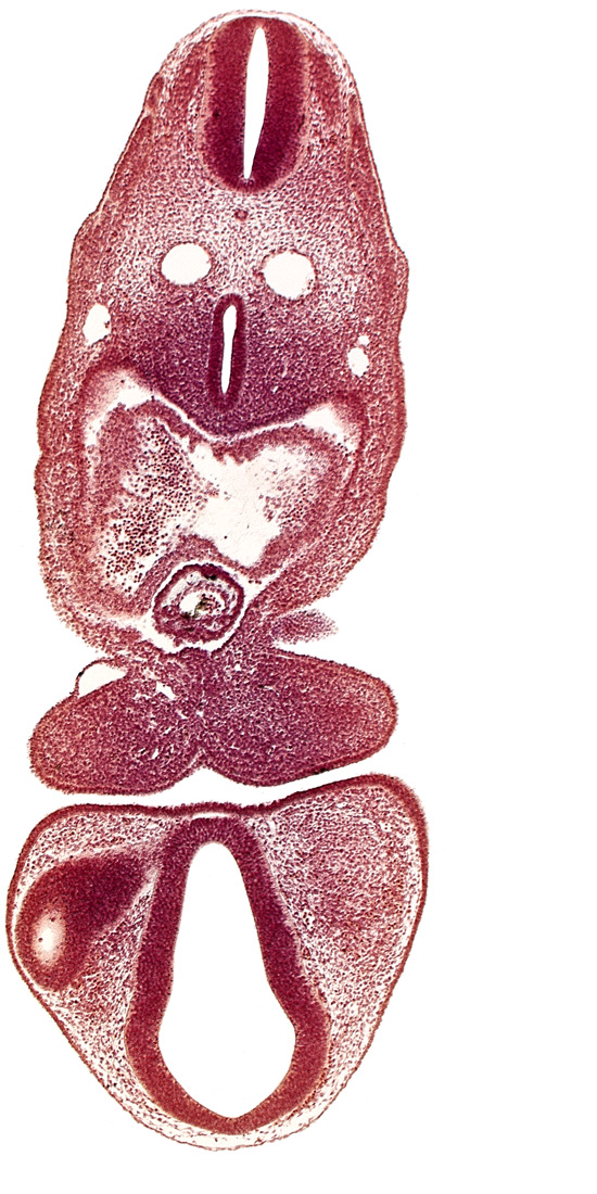 C-1 spinal ganglion primordium, caudal edge of pharyngeal arch 2, dermatomyotome 5 (C-1), dermatomyotome 6 (C-2), dorsal aorta, dorsal thalamus (diencephalon), left atrium, mandibular prominence of pharyngeal arch 1, optic vesicle, pericardial cavity, prosencoel (third ventricle), tracheo-esophageal tube, truncus arteriosus