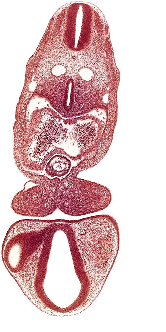 C-1 spinal ganglion primordium, dermatomyotome 5 (C-1), dermatomyotome 6 (C-2), dorsal aorta, dorsal thalamus (diencephalon), left atrium, mandibular prominence of pharyngeal arch 1, optic vesicle, pericardial cavity, primary interatrial septum (septum primum), prosencoel (third ventricle), tracheo-esophageal tube, truncus arteriosus