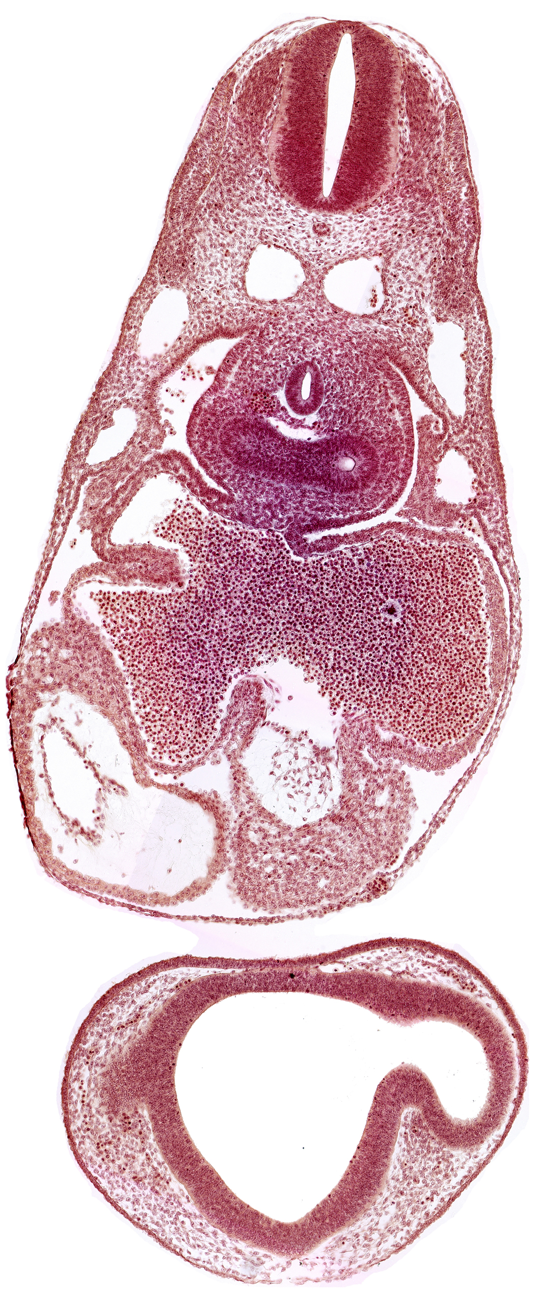 common atrioventricular canal, common cardinal vein, dermatomyotome 7 (C-3), epimyocardium, esophagus primordium, intraretinal space (optic vesicle cavity), left atrium, left lung bud, notochord, pericardial cavity, pericardioperitoneal canal (pleural cavity), postcardinal vein, primary interatrial septum (septum primum), prosencoel (third ventricle), right atrium, right lung bud, sinus venosus, ventral thalamus (diencephalon)
