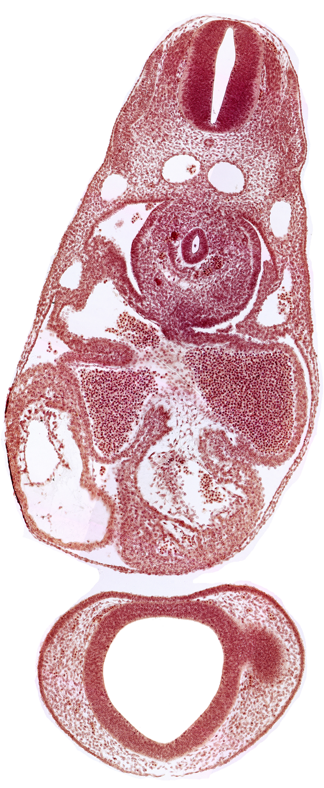 C-3 spinal ganglion primordium, caudal edge of optic vesicle, common atrioventricular canal (isthmus), common cardinal vein, dermatomyotome 7 (C-3), dorsal aorta, endocardium, epimyocardium, esophagus primordium, interventricular sulcus, left atrium, notochord, postcardinal vein, prosencephalon (telencephalic part), prosencoel (third ventricle), sinu-atrial foramen, sinus venosus, trabecular part of left ventricle