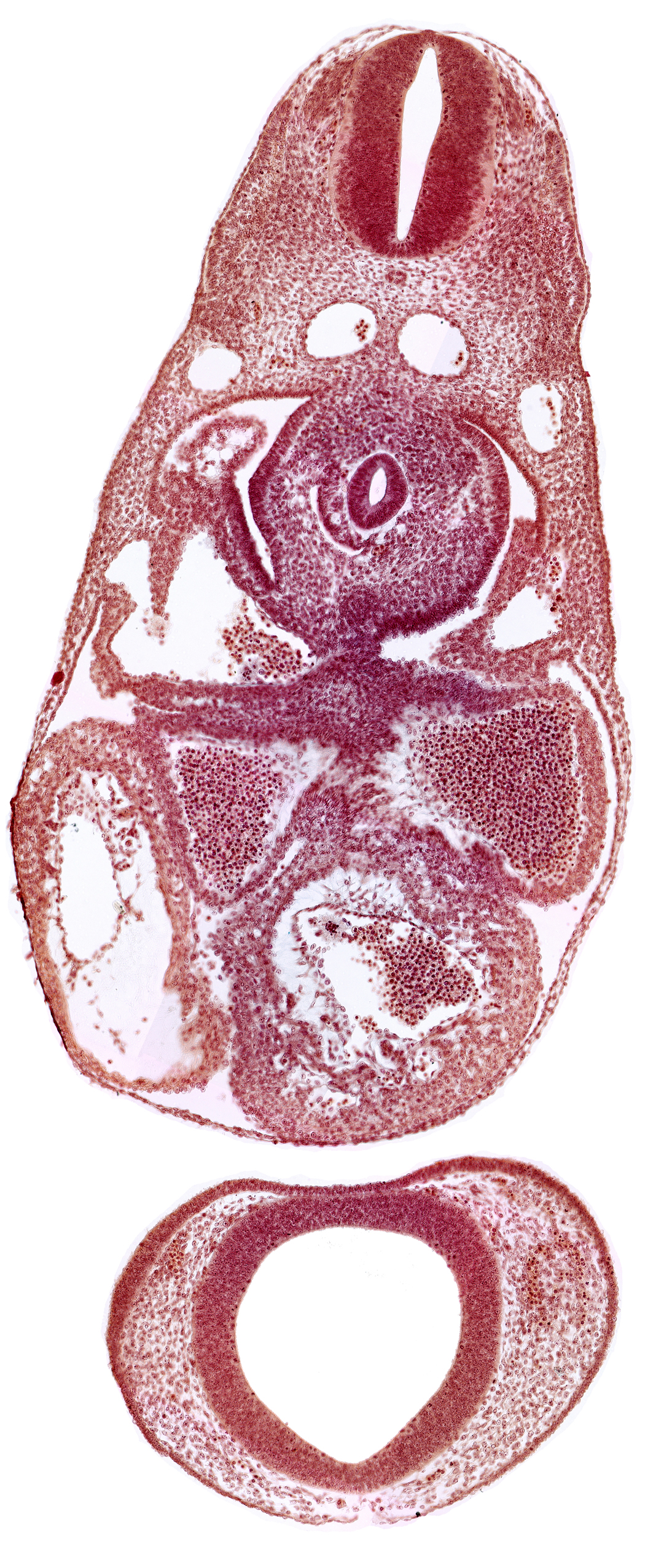C-3 spinal ganglion primordium, anterior cerebral plexus, common cardinal vein, dermatomyotome 7 (C-3), dorsal aorta, endocardium, epimyocardium, interventricular sulcus, left atrium, notochord, postcardinal vein, prosencephalon (telencephalic part), prosencoel (third ventricle), trabecular part of left ventricle
