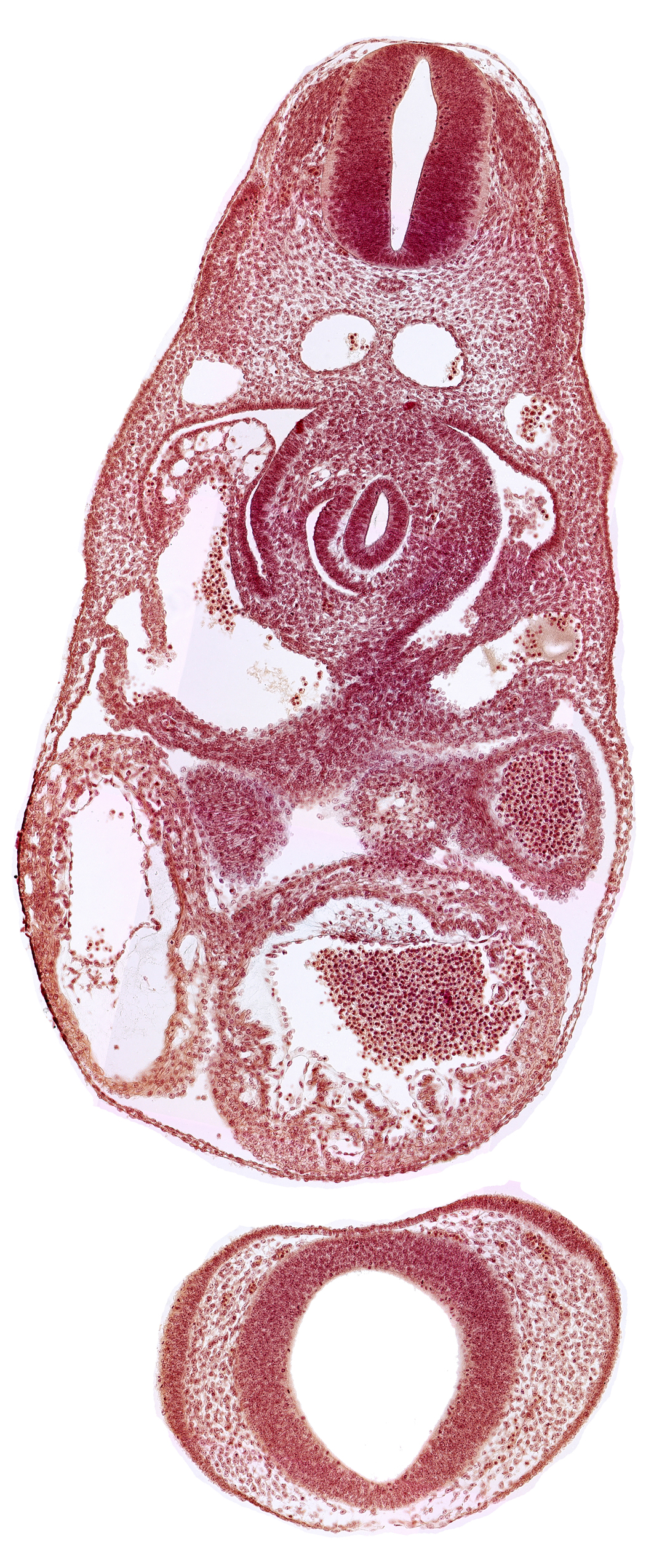 C-3 spinal ganglion primordium, dermatomyotome 7 (C-3), dorsal aorta, endocardium, junction of left common cardinal and left umbilical veins with left sinus horn, junction of right hepatocardiac vein and sinus venosus, nasal disc (olfactory placode), notochord, postcardinal vein, prosencephalon (telencephalic part), prosencoel (third ventricle), trabecular part of left ventricle