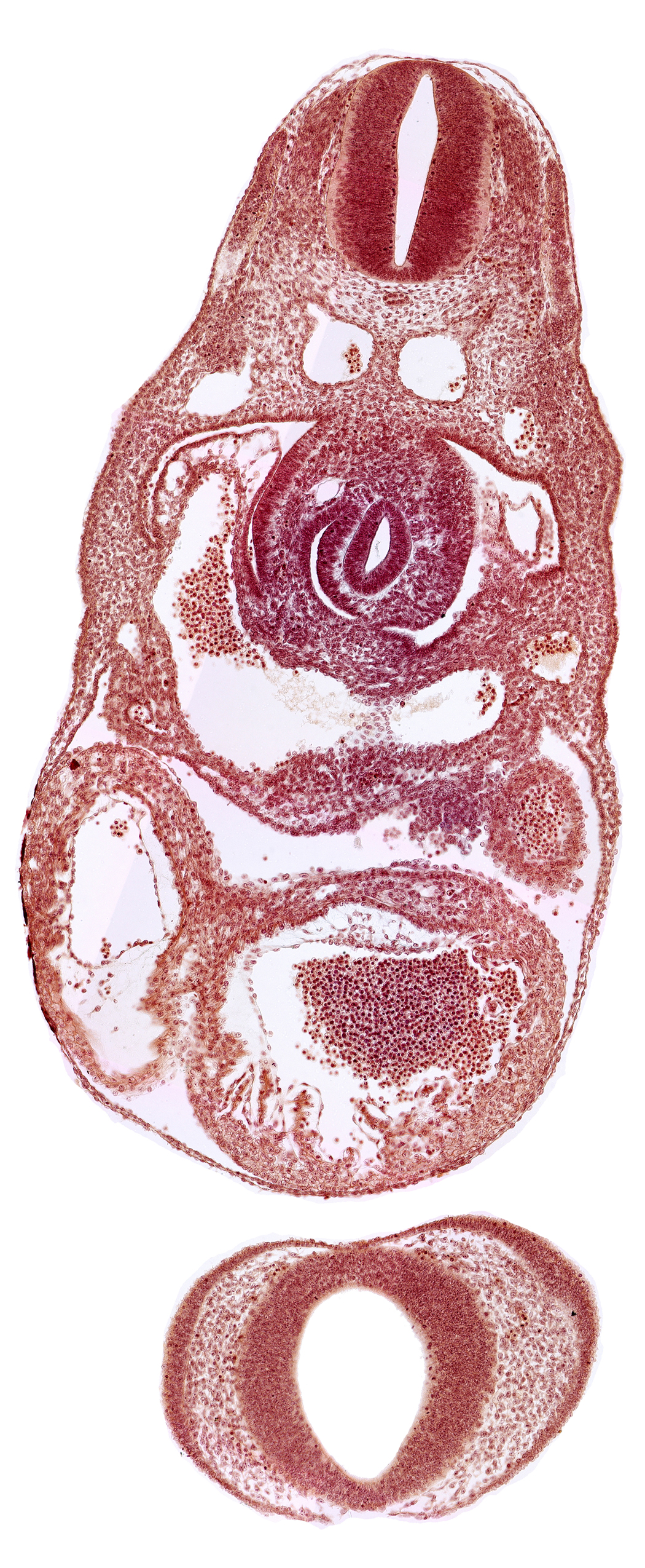 C-3 spinal ganglion primordium, dorsal aorta, junction of left common cardinal vein and sinus venosus, left ventricle, nasal disc (olfactory placode), notochord, postcardinal vein, prosencephalon (telencephalic part), prosencoel (third ventricle), sinus venosus, stomach primordium