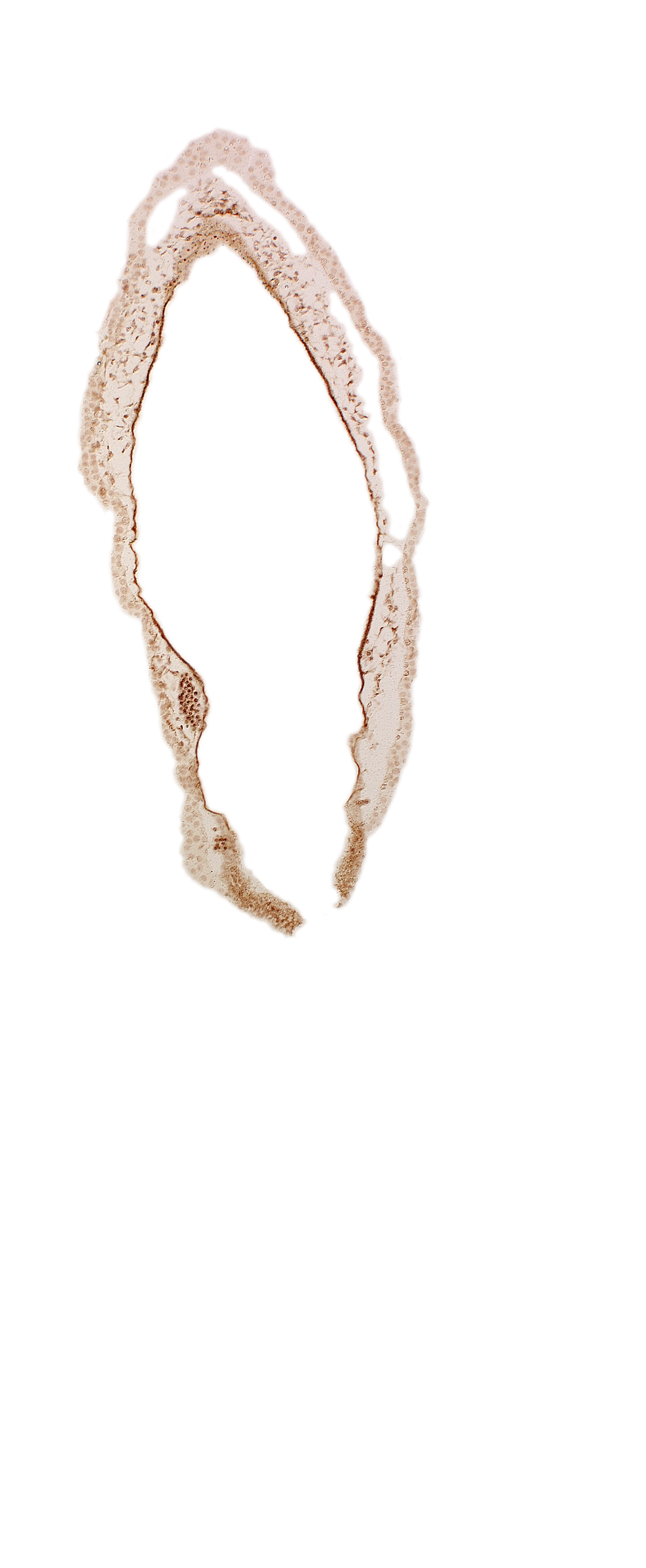 rhombencoel (fourth ventricle), roof plate of rhombencephalon, surface ectoderm, venous plexus(es)