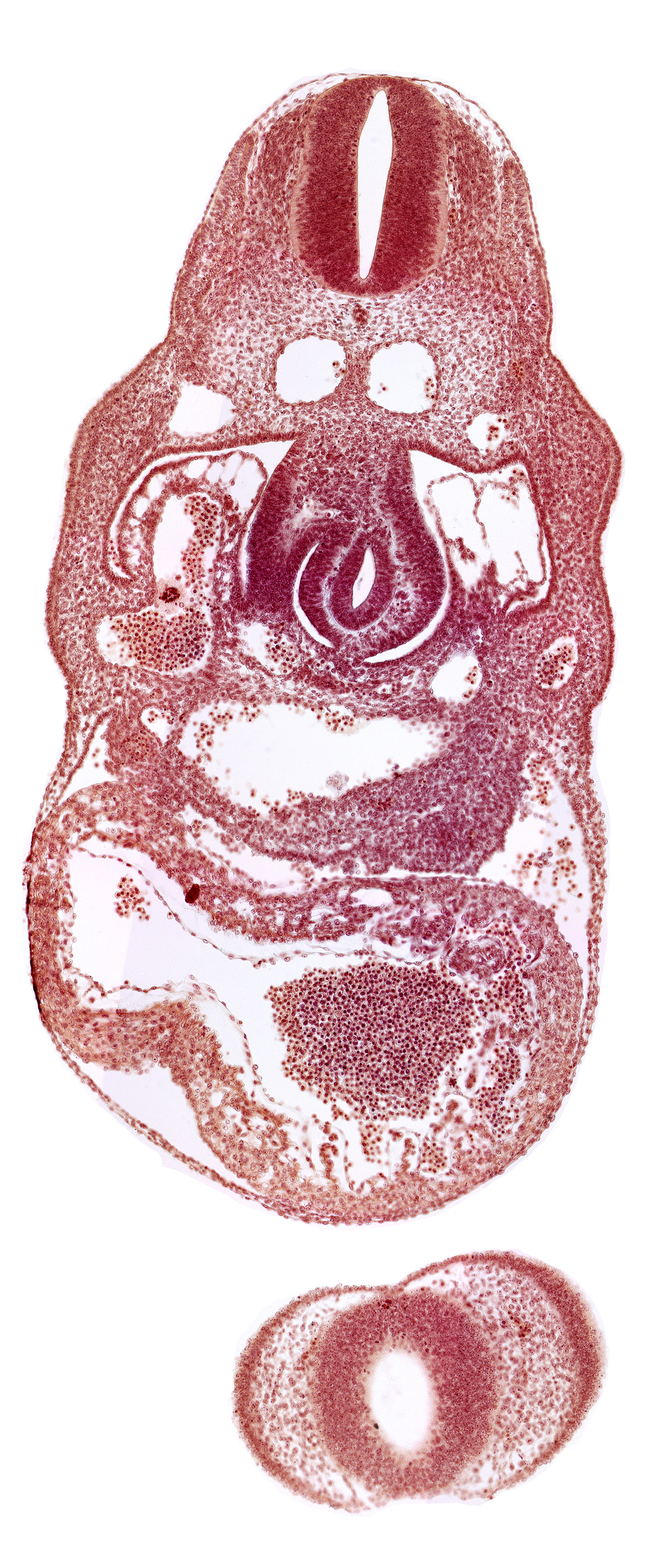 C-4 spinal ganglion primordium, anterior interventricular sulcus, cephalic edge of upper limb bud, dermatomyotome 8 (C-4), dorsal aorta, endocardium, epimyocardium, interventricular foramen, junction of hepatocardiac and umbilical veins, left umbilical vein, nasal disc (olfactory placode), notochord, postcardinal vein, prosencoel (third ventricle), stomach primordium, telencephalon medium, trabecular part of left ventricle
