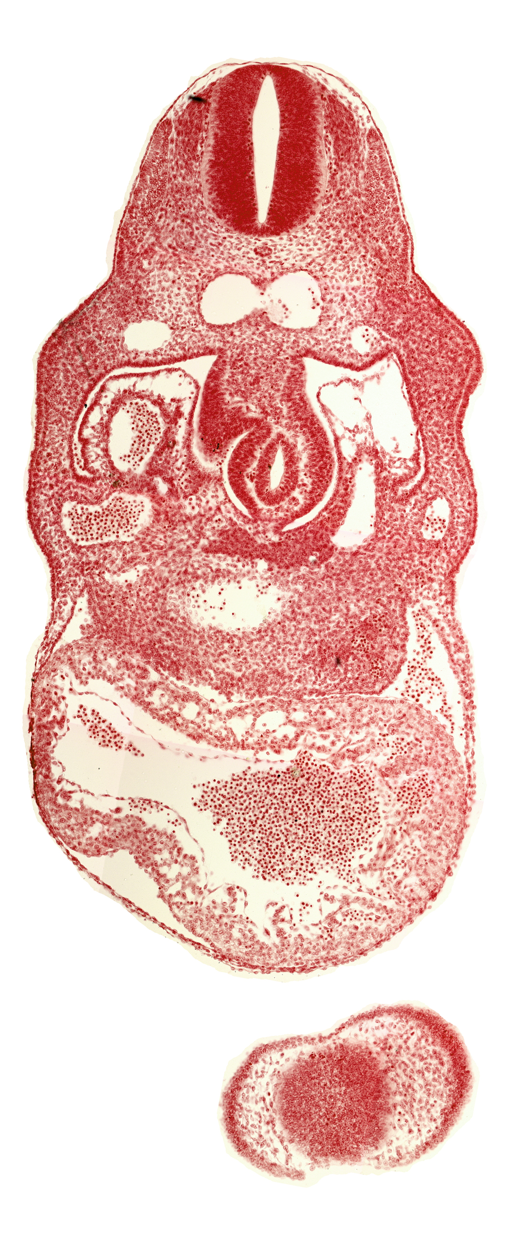 anterior interventricular sulcus, dermatomyotome 8 (C-4), hepatic lamina(e), hepatocardiac vein, interventricular foramen, junction of left and right dorsal aortas, lamina terminalis of prosencephalon, nasal disc (olfactory placode), notochord, pericardial cavity, right umbilical vein, trabecular part of left ventricle, upper limb bud