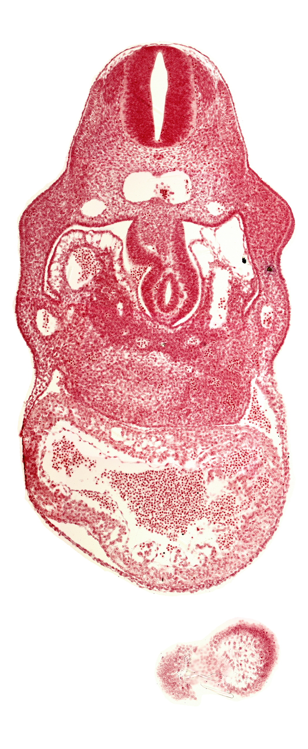anterior interventricular sulcus, cephalic part of head, hepatic lamina(e), hepatic sinusoid, hepatocardiac vein, notochord, right umbilical vein, united dorsal aortas, upper limb bud
