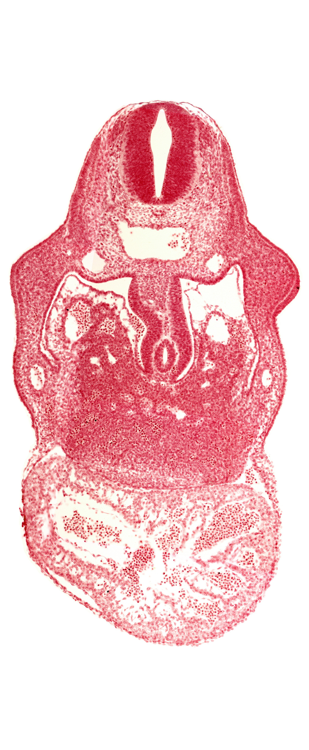 anterior interventricular sulcus, cephalic edge of septum tranversum, coelomic cavity, dermatomyotome 8 (C-4), dorsal mesogastrium, endocardium, hepatic lamina(e), hepatic sinusoid, hepatocardiac vein, notochord, postcardinal vein, primary interventricular foramen, right umbilical vein, stomach primordium, united dorsal aortas, upper limb bud, ventral mesogastrium