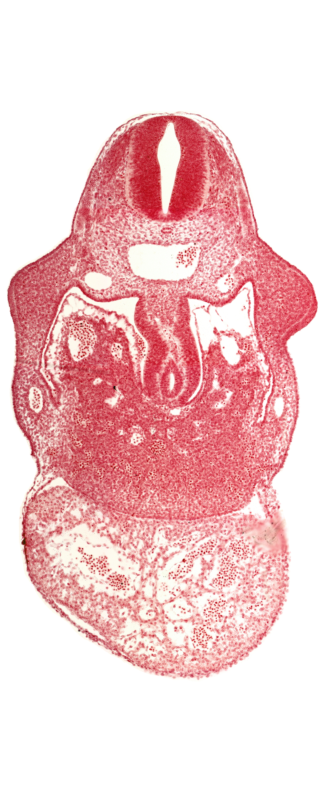 alar plate(s), basal plate, coelomic cavity, hepatic sinusoid, junction of duodenum and stomach primordia, left ventricle, pericardial cavity, postcardinal vein, right umbilical vein, right ventricle: endocardium, right ventricle: epimyocardium, septum transversum, specialized coelomic wall, upper limb bud