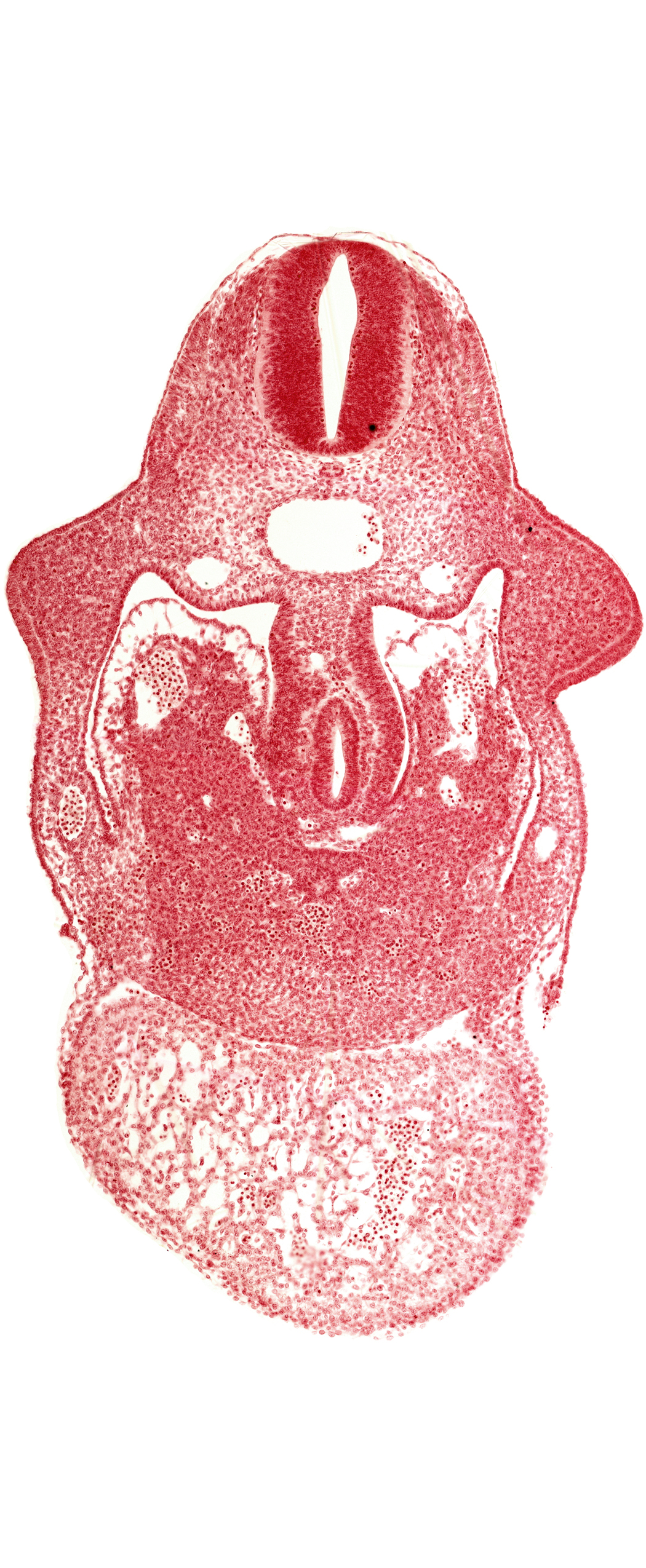 alar plate(s), basal plate, coelomic cavity, common aorta, dorsal pancreatic bud, duodenum primordium, hepatic lamina(e), hepatic sinusoid, notochord, postcardinal vein, septum transversum, specialized coelomic wall