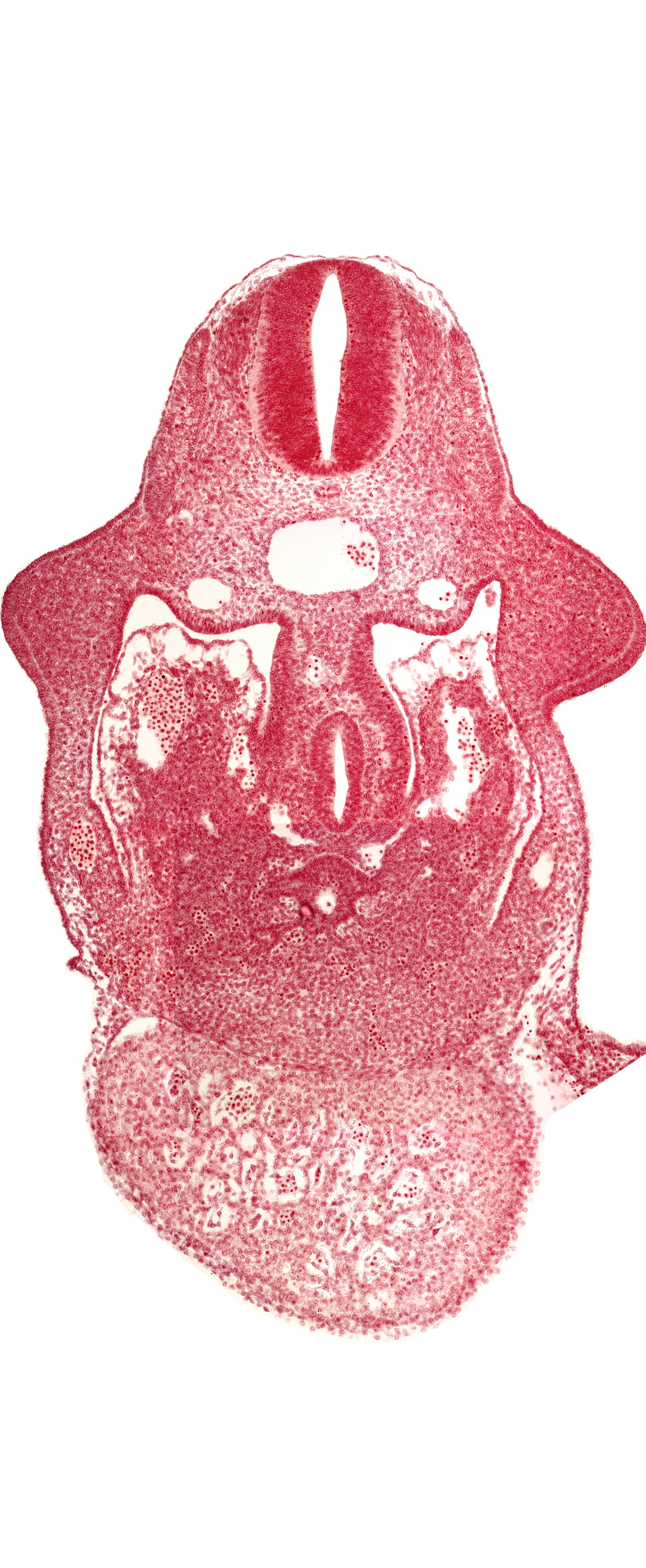 alar plate(s), basal plate, coelomic cavity, common aorta, common ventricle, dermatomyotome 9 (C-5), dorsal pancreatic bud, duodenum primordium, hepatic lamina(e), hepatic sinusoid, hepatocardiac vein, postcardinal vein, septum transversum, specialized coelomic wall, upper limb bud