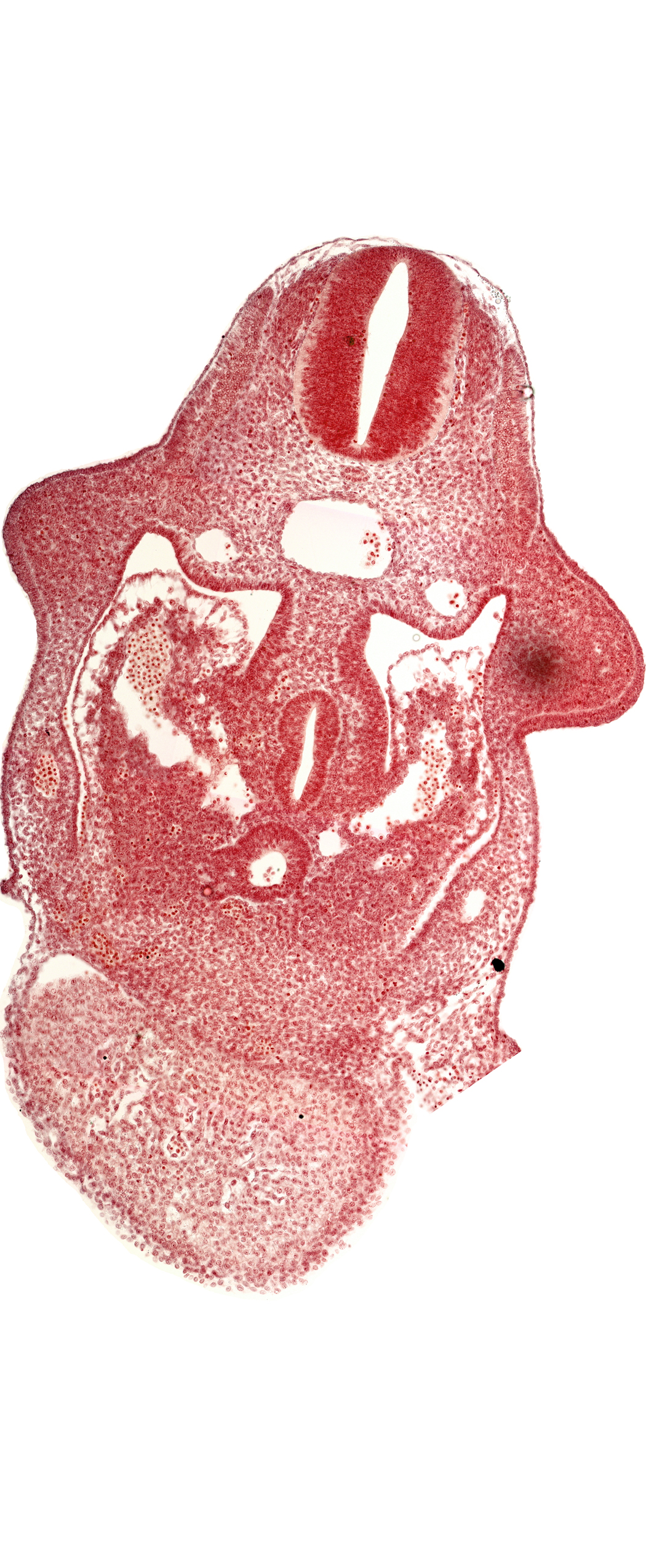 alar plate(s), amnion attachment, basal plate, coelomic cavity, common aorta, common ventricle, dorsal pancreatic bud, duodenum primordium, hepatic antrum, hepatocardiac vein, left umbilical vein, postcardinal vein, septum transversum, upper limb bud