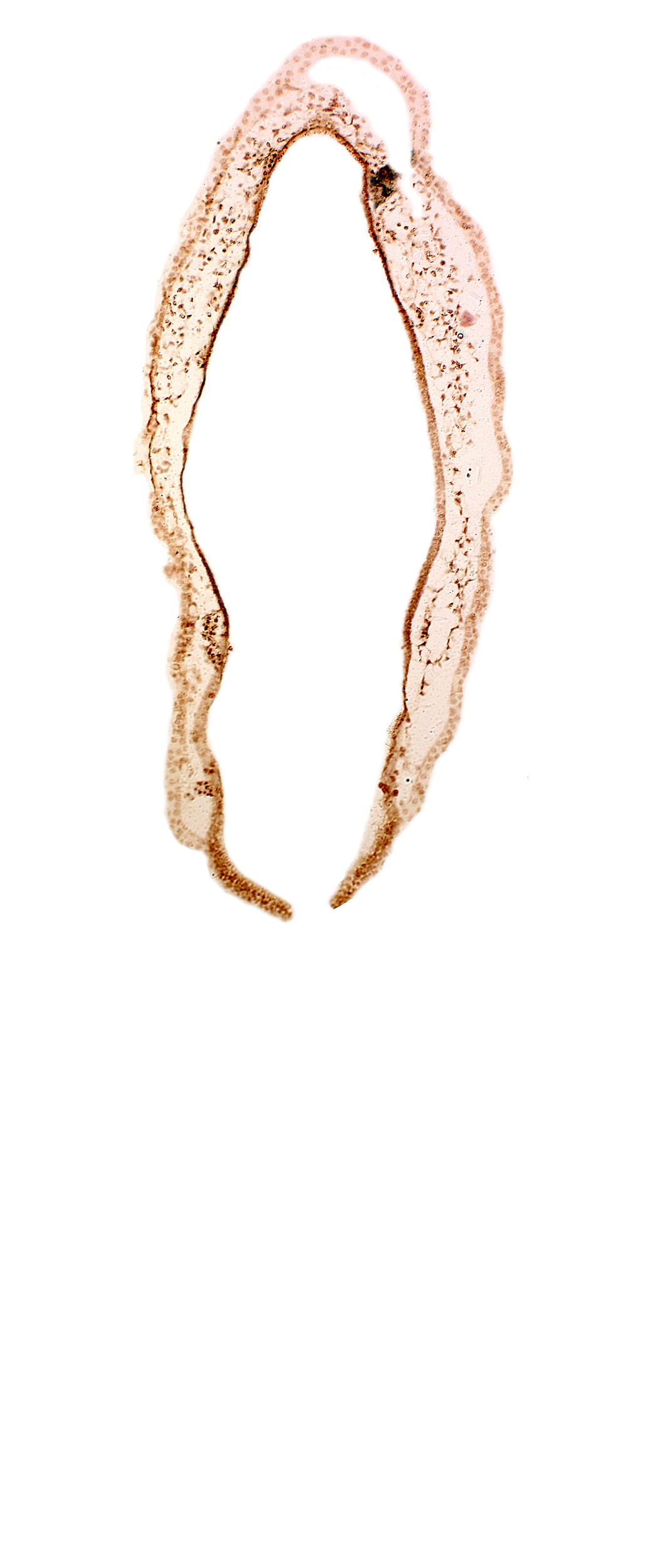 alar plate(s), head mesenchyme, rhombencoel (fourth ventricle), roof plate of rhombencephalon, surface ectoderm, venous plexus(es)