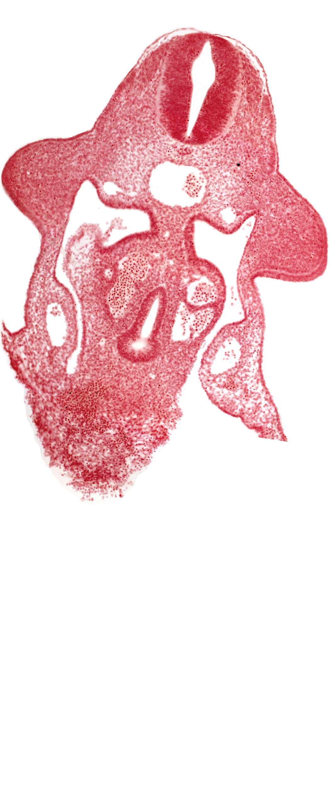 amnion attachment, aorta, apical ectodermal ridge, coelomic cavity, duodenum primordium, neural tube, postcardinal vein, sulcus limitans, upper limb bud