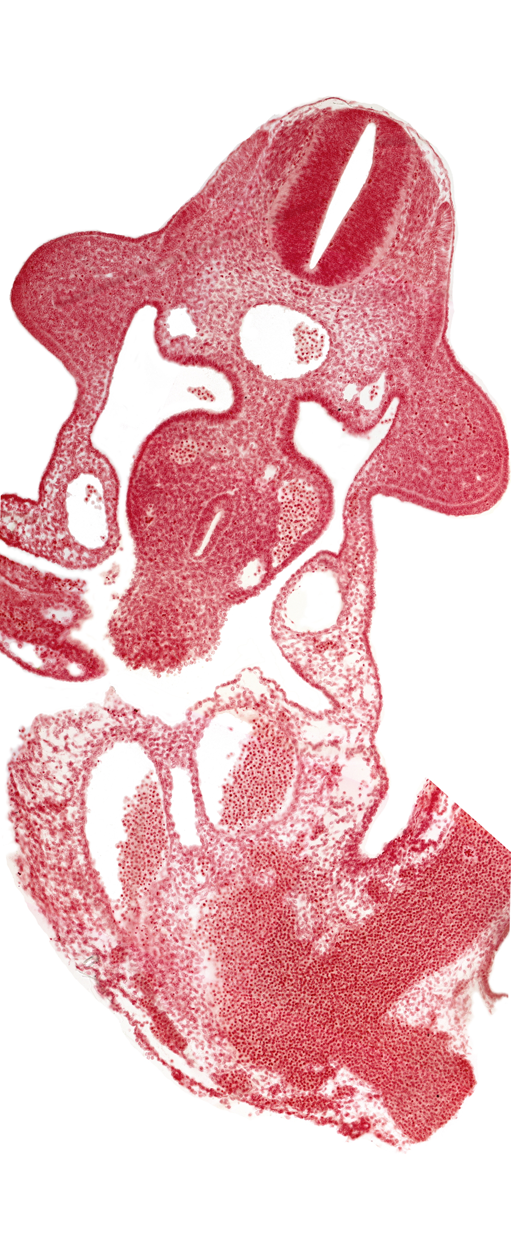 C-6 spinal ganglion primordium, allantois, aorta, apical ectodermal ridge, coelomic cavity, common umbilical vein, communication between coelomic cavity and extra-embryonic coelom, dermatomyotome 10 (C-6), dorsal mesentery, left umbilical artery, left vitelline (omphalomesenteric) vein, midgut, neural canal, postcardinal vein, right umbilical artery, umbilical vesicle stalk, upper limb bud