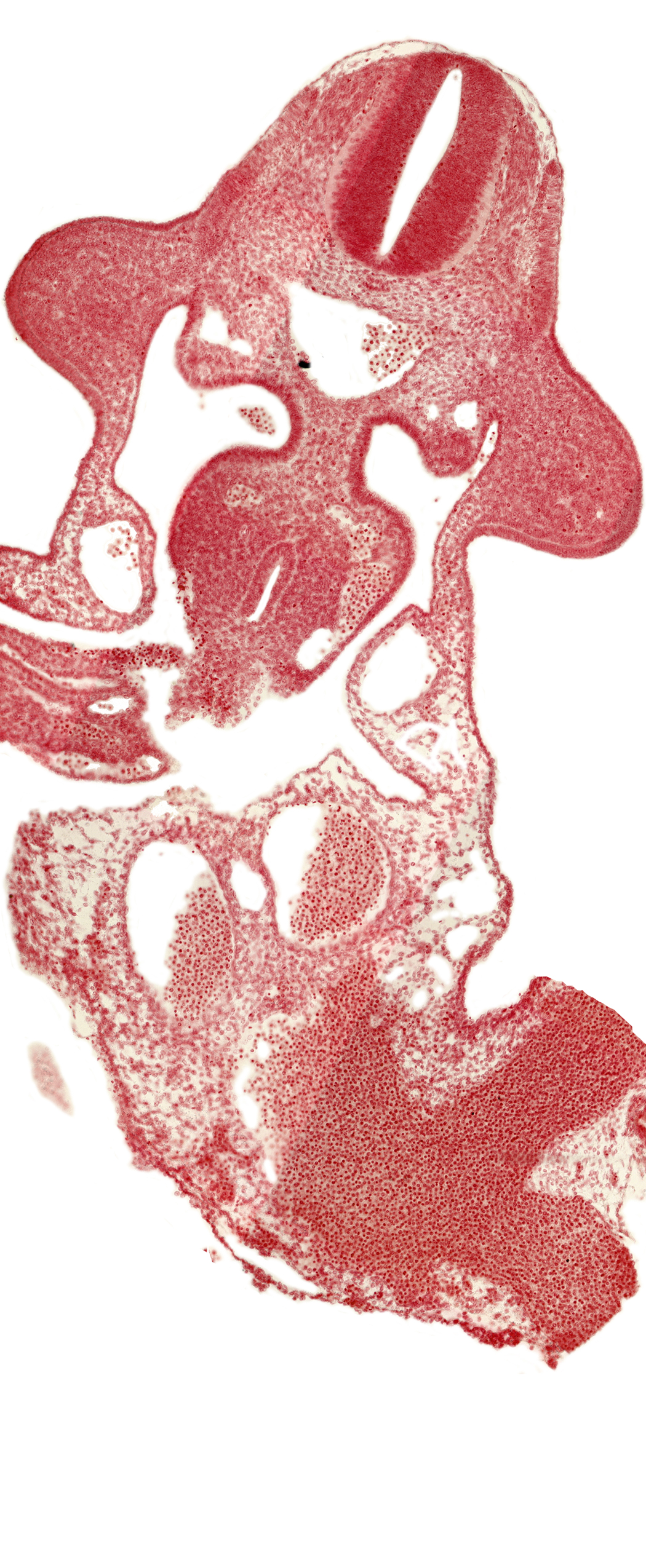 allantois, cephalic end of mesonephros, common umbilical vein, dermatomyotome 10 (C-6), dorsal mesentery, left umbilical artery, left umbilical vein, left vitelline (omphalomesenteric) vein, marginal layer, midgut, neural tube, omphaloenteric duct, postcardinal vein, right umbilical artery, right umbilical vein, subcardinal vein, upper limb bud