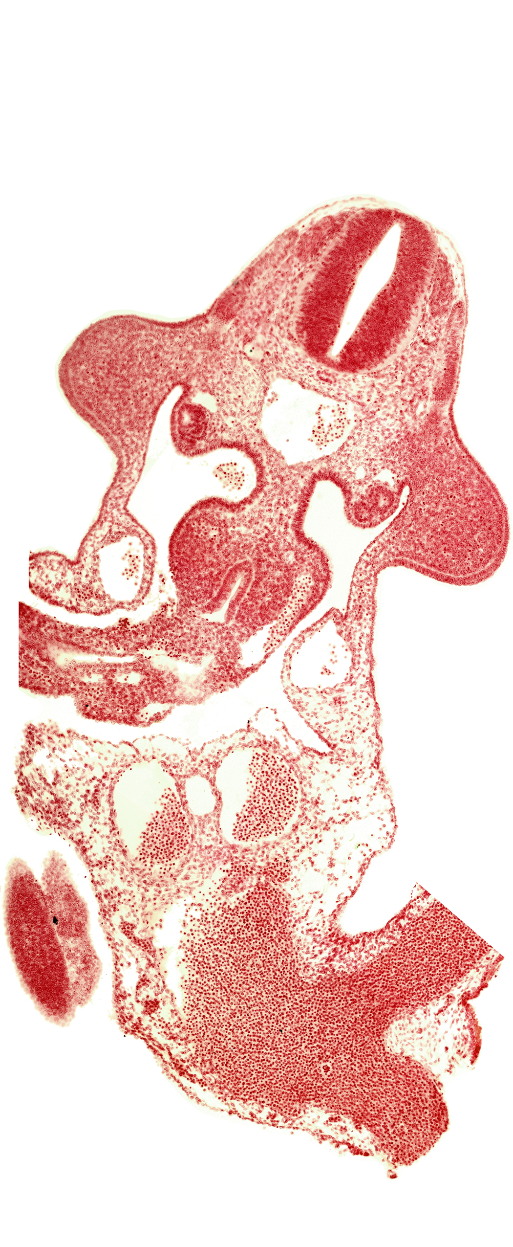 C-6 spinal ganglion primordium, allantois, aorta, cephalic end of mesonephros, cephalic limb bud mesenchyme, common umbilical vein, dermatomyotome 10 (C-6), edge of somite 32 (S-3), gonadal epithelium, left umbilical artery, left umbilical vein, marginal layer, mesonephric vesicle(s), midgut, omphaloenteric duct, origin of intersegmental artery, origin of vitelline (omphalomesenteric) artery, postcardinal vein, roof plate, subcardinal vein, sulcus limitans, vitelline (omphalomesenteric) vein