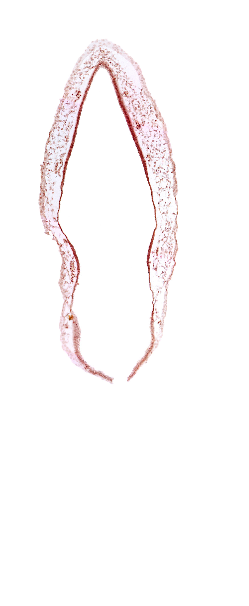 alar plate(s), head mesenchyme, rhombencoel (fourth ventricle), roof plate of rhombencephalon, surface ectoderm, venous plexus(es)